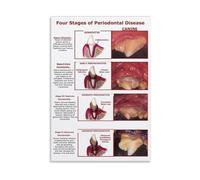KCDFDVJFBM Dog Periodontal Disease Poster Canine Four Stages Guide Gingivitis to Tooth Loss Chart Wall-Art for Pet Care Clinic Office Decor(Framed,12x18inch(30x45cm))