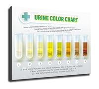 KCDFDVJFBM Gym Locker Room Poster Urine Color Chart Water Intake Guide for Bathroom Home Health Education(Framed,16x24inch(40x60cm))