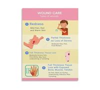 KCDFDVJFBM Hospital Poster Wound Care Tips First Aid Educational Guide Canvas Print Wall-Art for Clinic Nursing Bedroom Living Room Decor(Framed,08x12inch(20x30cm))