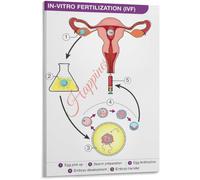 KCDFDVJFBM In Vitro Fertilization IVF Process Diagram Poster Fertility Chart Educational Canvas Wall-Art Living Room Bedroom(Framed,08x12inch(20x30cm))