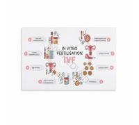 KCDFDVJFBM IVF Process Cycle Infographic Poster Fertility Educational Wall-Art Canvas Print Home Decor Living Room Bedroom(Unframed,08x12inch(20x30cm))