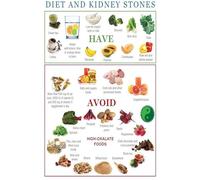 KCDFDVJFBM Kidney Stone Prevention Diet - Food List and Nutrition Guide, What to Eat and Avoid Chart for Kitchen, Clinic(Framed,12x18inch(30x45cm))