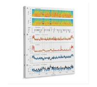 KCDFDVJFBM Sleep Study Poster - EEG Readings & Brain Wave Chart, Educational Reference for Doctor's Office Decor(Framed,12x18inch(30x45cm))