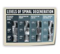 KCDFDVJFBM Spine Anatomy Art Print - Detailed Diagram of Vertebral Column, Educational Science Wall Decor for Chiropractor Office, Study, Clinic(Unframed,08x12inch(20x30cm))