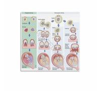 KCDFDVJFBM Twin Pregnancy Placentation Educational Anatomy Poster Office Clinic Wall Decor Canvas Print Human Body Science Diagram for Doctors Nurses Students(Framed,20x20inch(50x50cm))