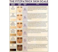 KCDFDVJFBM Vintage Science Tin Poster The Fitzpatrick Scale Skin Typology Chart Retro Metal Sign for Home Office Library Decor(Unframed,16x24inch(40x60cm))