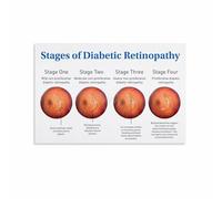 KCDFDVJFBM Vision Care Educational Chart Canvas Print Eye Anatomy Health Knowledge Guide Informative Poster for Doctor Office Clinic Wall Decor Gift(Framed,16x24inch(40x60cm))