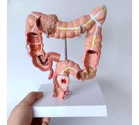 KCOAG Modelo anatómico del Colon Humano, Modelo de patologías del Colon, Sistema digestivo Humano, a Escala Real (1:1), para la enseñanza de la anatomía y fisiología humanas