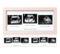 KeaBabies Marcos de fotos de sonograma para bebι, trνo de marcos de fotos de ultrasonido, regalo para mamα por primera vez, bonito marco de fotos