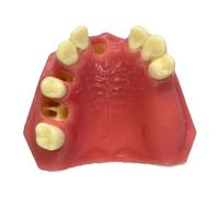 KH66ZKY Modelo de implante Dental maxilar - Modelo de práctica de implantes de Material Dental - Great Dental Training Tooth para la práctica de implantes dentales
