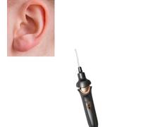 Kit Eléctrico de Eliminación de Cera para los Oídos,Aspiradora De Eliminación De Cera De Oídos Kit,Aspirador de Limpieza de Oídos para Adultos y Niños,Aplicable a diferentes grupos de personas.