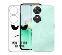 KJYFOANI Funda para Honor Play10C (6.61"), Ultrafino TPU Estuche Protector, Transparente Bumper Cover Suave Silicona Case, Anti-Arañazos Cáscara para - No me toques