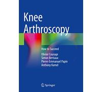 Knee Arthroscopy: How to Succeed