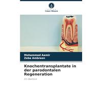 Knochentransplantate in der parodontalen Regeneration: Ein Überblick