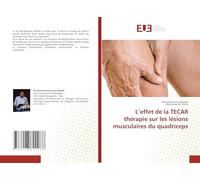 L'effet de la TECAR thérapie sur les lésions musculaires du quadriceps