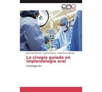 La cirugía guiada en implantología oral: Investigación