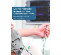 LA INTERPRETACIÓN DE LOS REGISTROS CARDIOTOCOGRÁFICOS.: Actuación de la matrona (MUJER,GENERO,REPRODUCCION)