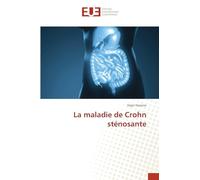 La maladie de Crohn sténosante