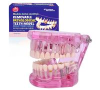 LA MIERE Dental Oral Typodont Modelo de dientes Implante Patológico Extraíble Enseñar Demo Anatomía Visible Demostración Enseñanza Tamaño Estándar (Rosa) Set de regalo