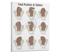 Labor and Delivery Wall-Art Fetal Station Diagram Birth Positions Poster Canvas Print for Maternity Ward(Framed,12x18inch(30x45cm))