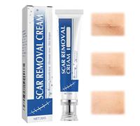 LAKVIL 30g Crema para Cicatrices, Desvanece las Estrías, Protege y Repara la Textura de la Piel, Restaura una Apariencia Lisa (B)