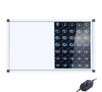 Lámpara De Visualización De Rayos X De Pared, Iluminador De Película De Rayos X LED, Brillo Variable, 1,3 Cm/0,5 Pulgadas De Grosor, for Uso Clínico(Medium)