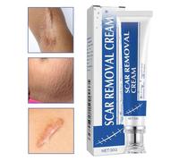 laxreheye Crema Para Eliminar Cicatrices,30g Producto Hidratante para Marcas de Rozaduras | Nueva Crema Reafirmante Para Cicatrices,Para Recuperacion Queloide Mujeres Hombres Atletas Rodillas Codos