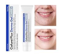 laxreheye Gel Para Granos - Tratamiento De Absorción Rápida Y Ligero Para Reparar Y Eliminar Imperfecciones | Gel Facial Eliminador De Granos,Para Chica Familia Amigos Colegas Uso Diario Viaje Noche