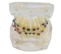 LBYLYH Modelo de ortodoncia Dental, patrón de Dientes congestionados oralmente con Medios de comunicación para la demostración del Estudio de la Apertura de la mandíbula.
