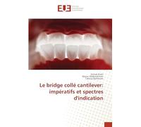 Le bridge collé cantilever: impératifs et spectres d'indication