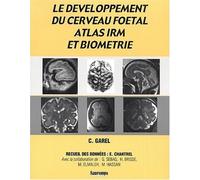 Le développement du cerveau foetal : Atlas IRM et biométrie de H Brisse (26 octobre 2000) Broché
