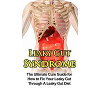 Leaky Gut Syndrome: The Ultimate Cure Guide for How to Fix Your Leaky Gut Through A Leaky Gut Diet (Leaky Gut Syndrome, Leaky Gut Diet)