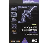 L'Echographie foetale normale en pratique volume 1: DVD vidéo
