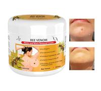 Lenaro Bee Ve-nom Eliminador de Verrugas Y Etiquetas, Crema Reparadora de Venenos de Abeja, Crema Hidratante de Veneno, Hidrata Y Suaviza La Piel, Crema para Eliminar Manchas para Todo Tipo de Piel