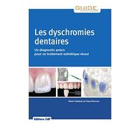 Les dyschromies dentaires: Un diagnostic précis pour un traitement esthétique réussi