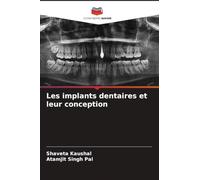 Les implants dentaires et leur conception