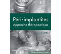 Les Péri-implantites (ebook)