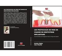 Les Protocoles de Mise En Charge En Dentisterie Implantaire: Vue d'ensemble des stratégies de mise en charge des implants