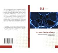Les sinusites fongiques: Aspects cliniques et prise en charge thérapeutique