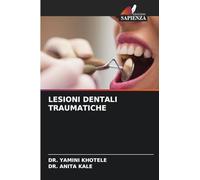 LESIONI DENTALI TRAUMATICHE
