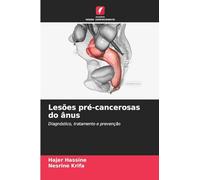 Lesões pré-cancerosas do ânus: Diagnóstico, tratamento e prevenção