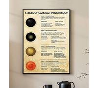 Letrero de hojalata vintage con las etapas de progresión de cataratas de un optometrista, cuadro de descripción del sistema de meridianos, póster retro de masaje corporal masculino, decoración diverti