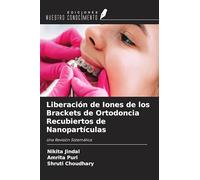 Liberación de Iones de los Brackets de Ortodoncia Recubiertos de Nanopartículas: Una Revisión Sistemática