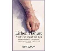 Lichen Planus: What They Didn’t Tell You: Understanding the Root Causes, Symptoms, and the Real-Life Impact of This Overlooked Condition