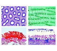 LIEDER Biología Microscopía Micro muestras Serien flor lose Plantas (Crypt ogamae): Razón Serie