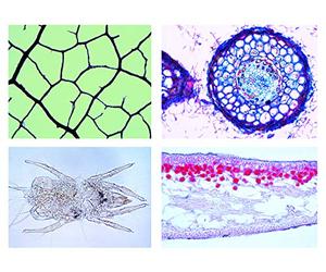 LIEDER Biología Microscopía Micro Muestras Serien Medio Ambiente Ii: Agua: Aguas Contaminación
