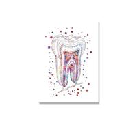 Lienzo de implante dental, pintura pared, póster arte Dental, impresiones anatomía dentista, imágenes artísticas médica, decoración clínica Hospital(Picture 6,A2 42x60cm no frame)