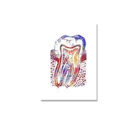 Lienzo de implante dental, pintura pared, póster arte Dental, impresiones anatomía dentista, imágenes artísticas médica, decoración clínica Hospital(Picture 1,50x70cm no frame)