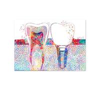 Lienzo pintura dentista pared arte médico higienista póster impresión Dental imágenes dientes implante acuarela clínica decoración del hogar(2,Fr A4 21x30cm No Frame)