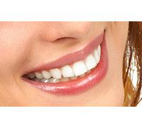 Limpieza bucal con pulido dental radiografía periapical y diagnóstico